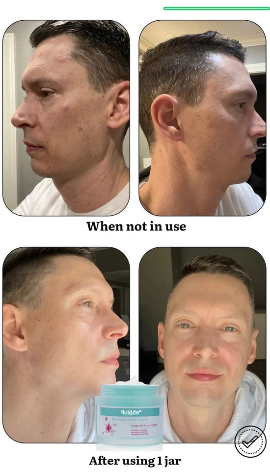 😍"Ruidda Renewal Face Cream – 5 All-Natural Ingredients, USA Family Farm Made, Centuries-Trusted for All Ages & Skin Types"