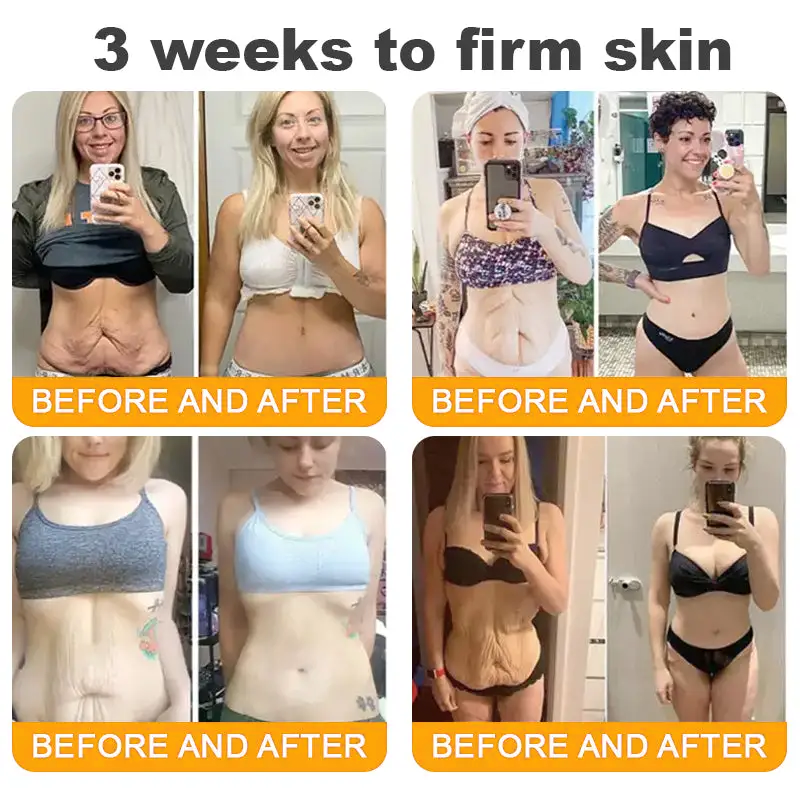 🛒🔥TLOPA® Bee Venom Repair Radiance Cream | Unlock Smooth Skin, Fight Sagging 🎁 Lightweight Daily Care, Limited-Time 70% OFF🔥🔥