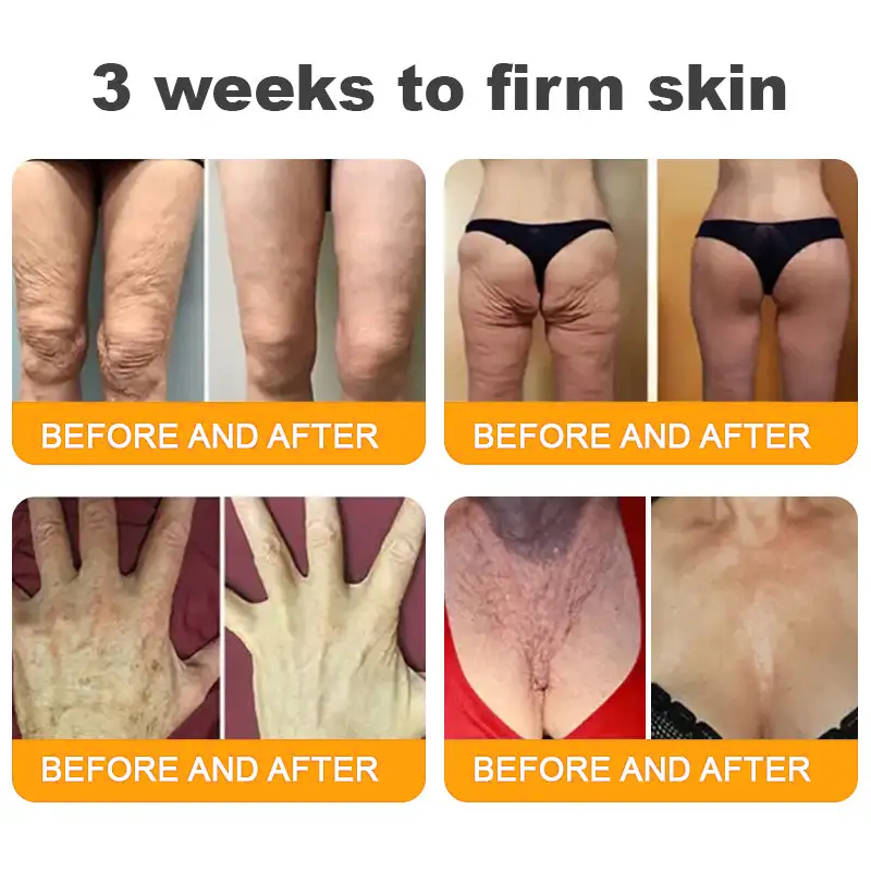 🛒🔥TLOPA® Bee Venom Repair Radiance Cream | Unlock Smooth Skin, Fight Sagging 🎁 Lightweight Daily Care, Limited-Time 70% OFF🔥🔥