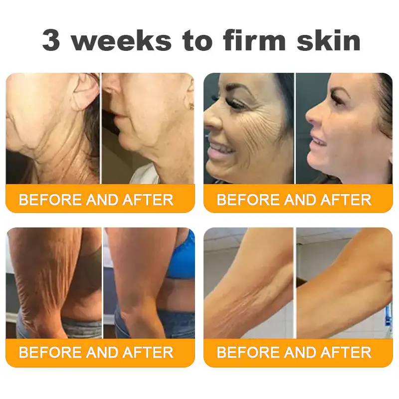 🛒🔥TLOPA® Bee Venom Repair Radiance Cream | Unlock Smooth Skin, Fight Sagging 🎁 Lightweight Daily Care, Limited-Time 70% OFF🔥🔥