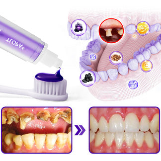 🥇TLOPA® IntelligeSmile Mineral Treatment Toothpaste