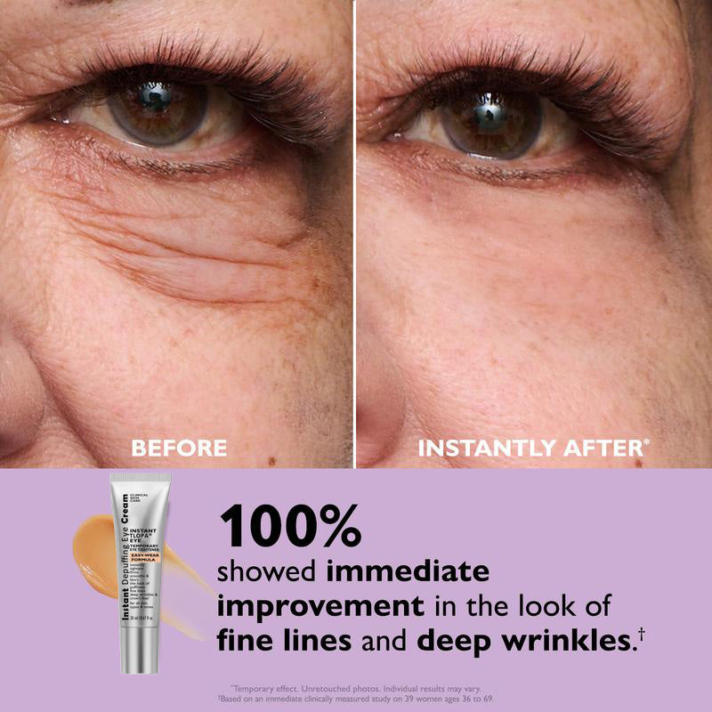 TLOPA® Instant Depuffing Eye Cream – Brighten & Smooth in 90 Seconds✨