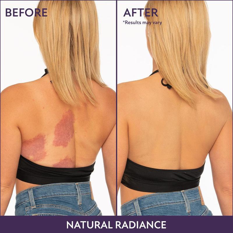 TLOPA® Tinted Moisturizer – Lightweight Hydration & Natural, Buildable Coverage for an Instant Glow💧✨ Lightweight & waterproof