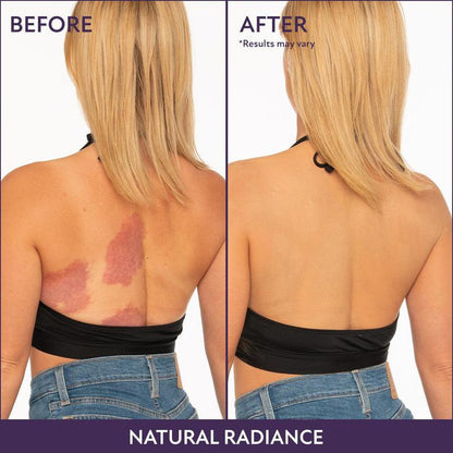 TLOPA® Tinted Moisturizer – Lightweight Hydration & Natural, Buildable Coverage for an Instant Glow💧✨ Lightweight & waterproof