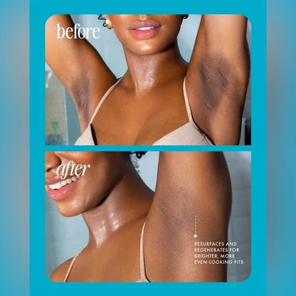 ⚡️Post-waxing rescue in 5 seconds: Bumps disappear, skin glows! Glass-Smooth serum